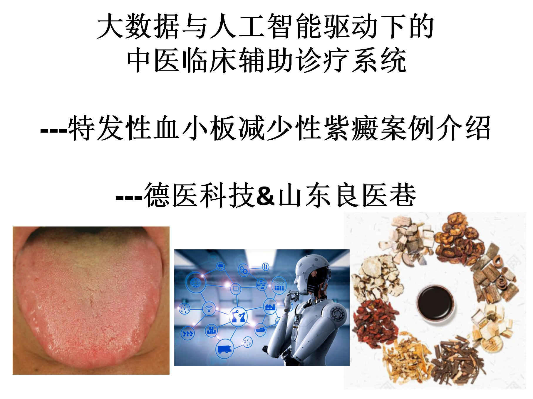 特发性血小板减少性紫癜案例